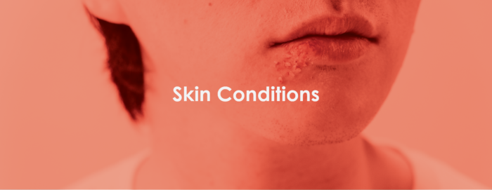 Skin Conditions