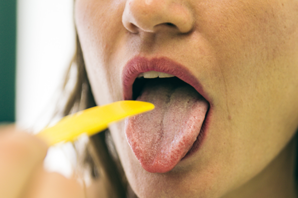 Understanding Mononucleosis